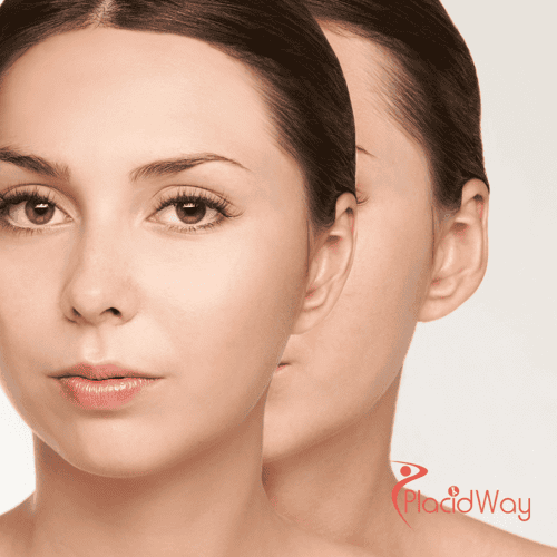Otoplasty in Turkey: An Affordable Option for UK Patients